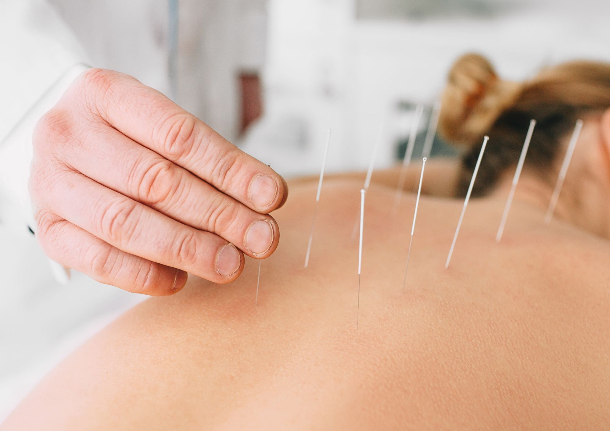 【簡潔編】やさしい鍼で、自律神経を整える/Bodyケア【松山市】