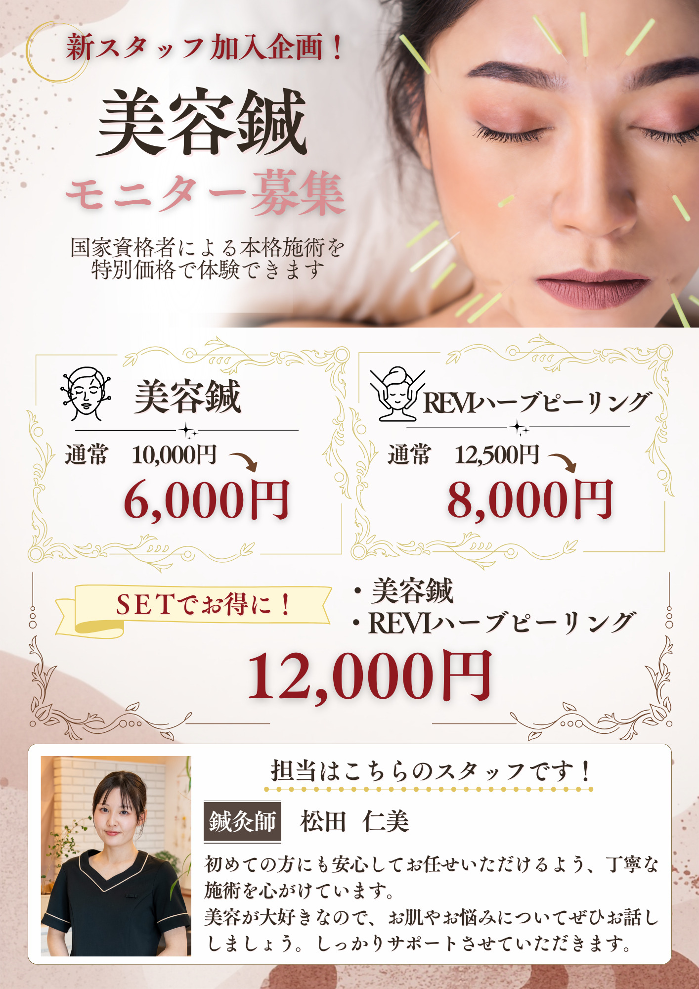 fulme.新スタッフ施術｜美容鍼モニター限定価格のご案内【松山市】